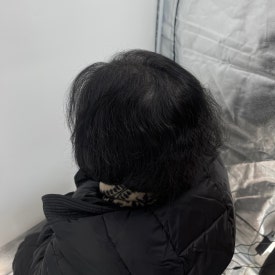 여성두피문신? 60대 실제 사례 사진으로 확인하세요 관련 이미지 10