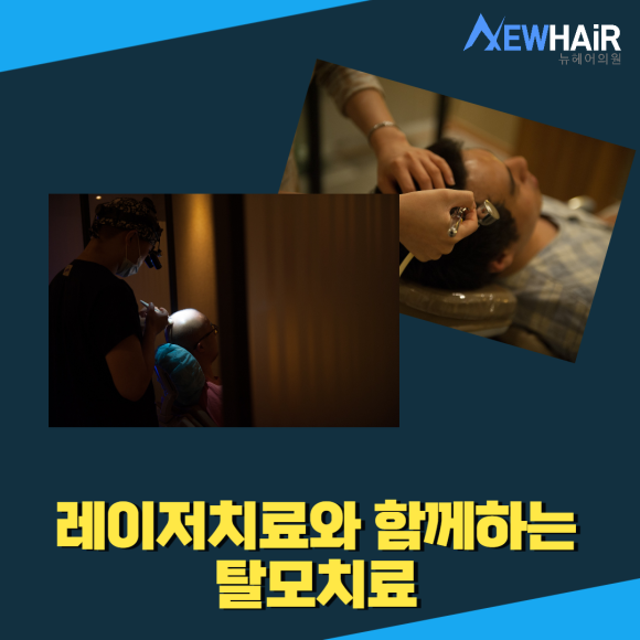 강남탈모 치료 정확히 알아보고 관련 이미지 4