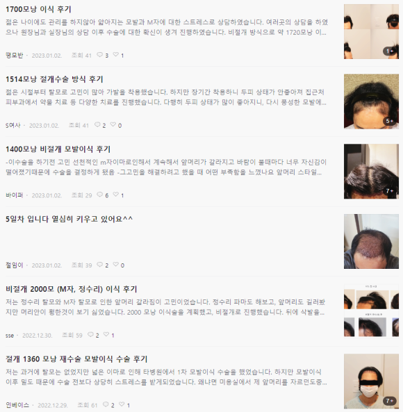 뉴헤어모발성형외과, 치료결과가 좋은 이유? - 17년차 성형외과전문의 김진오 드림 관련 이미지 1