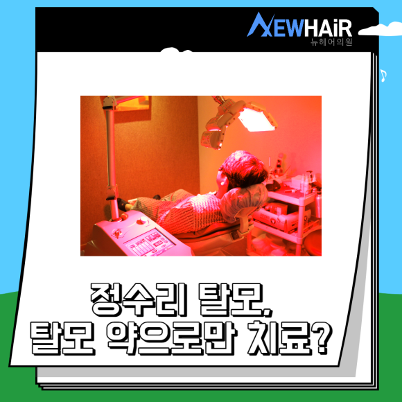 정수리탈모치료 더 늦지 않게 관련 이미지 5