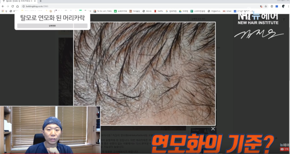 머리카락 굵어지는 법 가성비갑 월 3만원 이하 l 탈모 연모화의 기준은? 관련 이미지 2