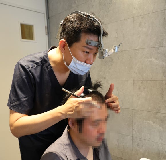 앞머리와 정수리가 같이 비었다면 어디부터 모발이식해야 할까? 관련 이미지 4