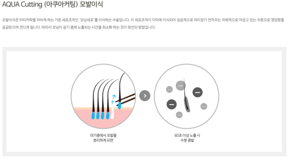 모발이식방법 자세히 알고 가세요 관련 이미지 6