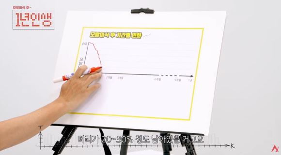 모발이식 암흑기 언제까지? 쉐딩과 차이, 이유 관련 이미지 5