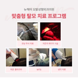 탈모유형, 어떻게 구분하고 관리해야 할까? 관련 이미지 13