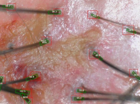 How Should You Start a Hair Loss Management Plan at First? image 4