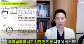 탈모약 복용 후 자살생각? 부작용의 실체 관련 이미지 6