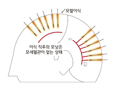 모발이식 후 담배는 언제부터? 관련 이미지 1