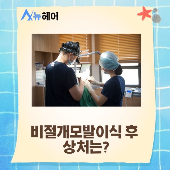 비절개모발이식 비용도 따져보고 관련 이미지 5