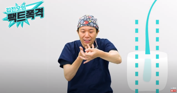 모발이식 개구리알 왜 생길까 l 슬릿의 오해 관련 이미지 2
