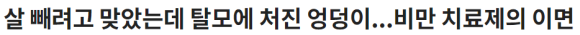 다이어트 약 (삭센ㅇ,오젬ㅇ)이 탈모를 생기게 한다?! 관련 이미지 2
