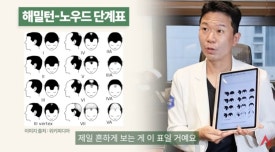 M자 탈모 초기, 그냥 넓은 이마와 어떻게 다를까? 탈모 FAQ 관련 이미지 4