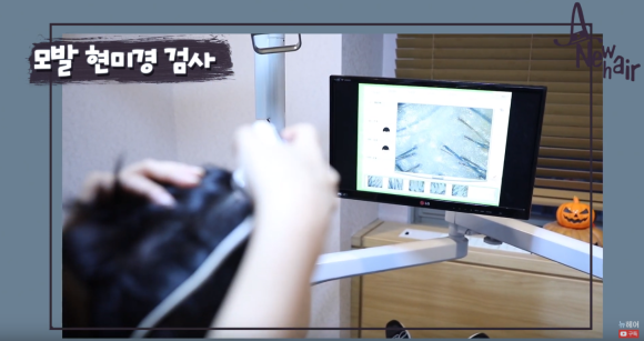 병원에서 하는 탈모 검사 방법 관련 이미지 3