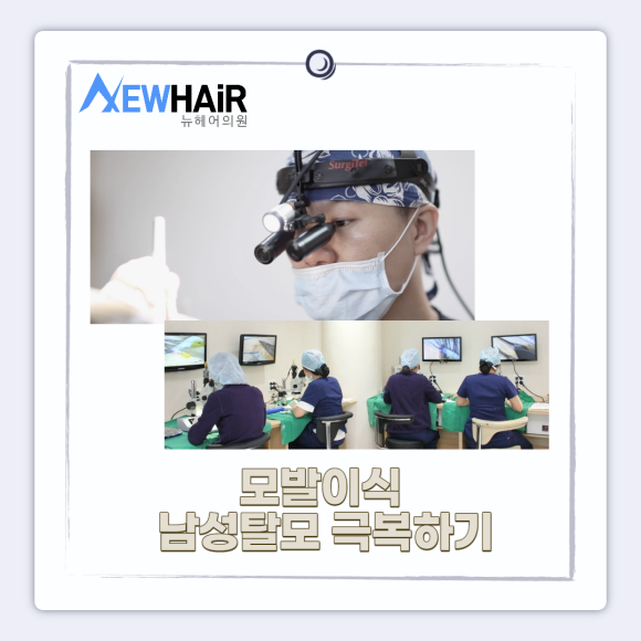 남성탈모 모발이식으로 해결 관련 이미지 6