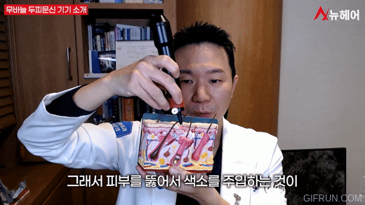 정수리 탈모, 가르마 탈모에 효과적인 무바늘 두피문신! 관련 이미지 4