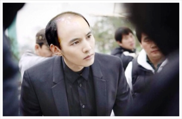 모낭재생주사 가격? 횟수? 주의사항? 전문의가 실토합니다 관련 이미지 2