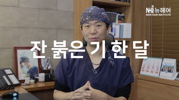 헤어라인교정(모발이식) 붉은 기... 언제 없어질까? 관련 이미지 4