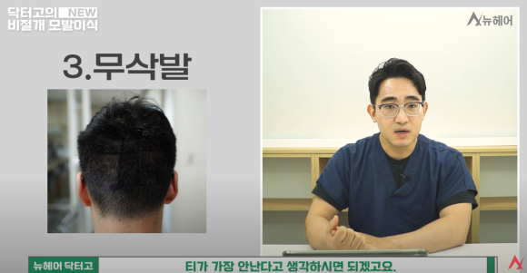 랜던 도노반의 사례로 본 모발이식 안전 영역과 채취 부위(비절개) 관련 이미지 7