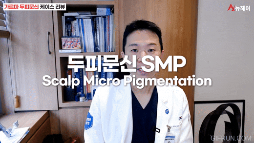 정수리탈모 가르마탈모 스트레스 때문에 두피문신했더니(두피문신 케이스리뷰) 관련 이미지 1