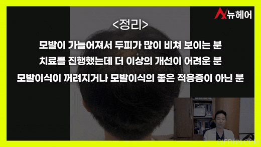 정수리두피문신 리얼 후기! 두피문신은 이런분들에게 추천합니다. 관련 이미지 9