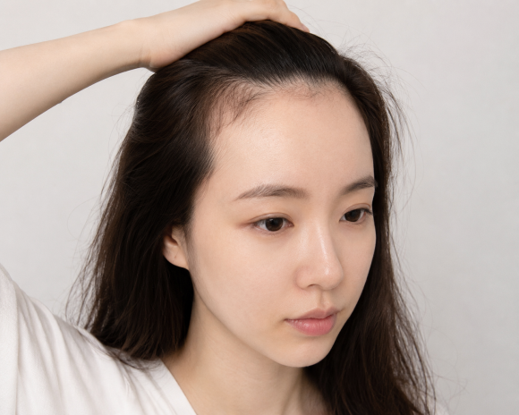 Female Hairline Hair Transplantation: Should It Be Done Differently for Women Than Men? FAQ from Design to Baby Hairs image 2