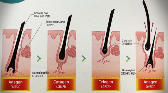 모발이식과 모발 생리학, 이해하면 성공이 보인다 관련 이미지 1