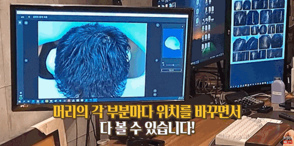 탈모진단병원? 의사는 관련 이미지 5
