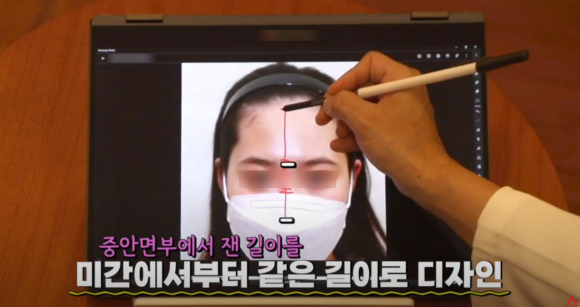 Hairline Design: What Criteria Should It Be Based On? image 3