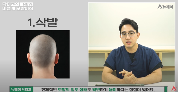 랜던 도노반의 사례로 본 모발이식 안전 영역과 채취 부위(비절개) 관련 이미지 5