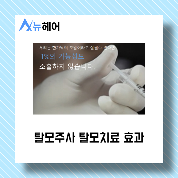 탈모치료 비수술로 가능하다? 관련 이미지 3