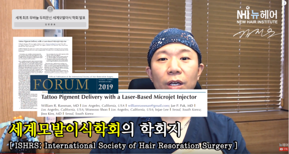 두피문신 新기술ㅣ무바늘 레이저 두피문신 vs.두피문신 차이점 관련 이미지 2