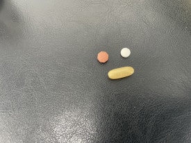 하루에 담배 00개비 피우면 탈모로 대머리 된다? 관련 이미지 5