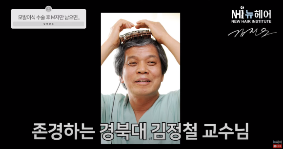 [뉴헤어] M자 엠자 모발이식 후 더듬이됐다? l  모발이식 후 탈모가 온다면... 관련 이미지 2