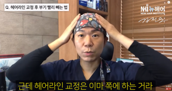 [뉴헤어] 모발이식 의사가 말하는 헤어라인 교정 후 부기 빨리 빼는 법 관련 이미지 2