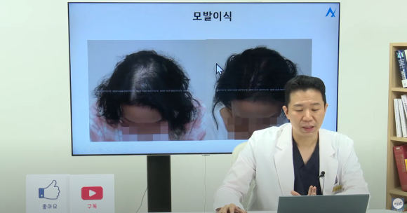 [비온뒤X뉴헤어]여성 탈모치료, 탈모 이렇게 치료해요 관련 이미지 9