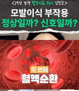 19년차 의사가 답하는 모발이식 부작용 FAQ(쉐딩, 모낭염, 괴사) 관련 이미지 5