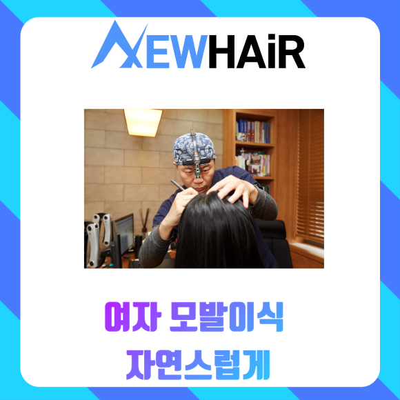 여자 모발이식 자연스럽게 관련 이미지 1