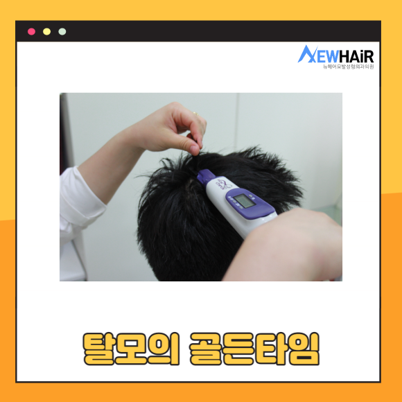 탈모정밀검사로 탈모검사 확실하게 관련 이미지 4