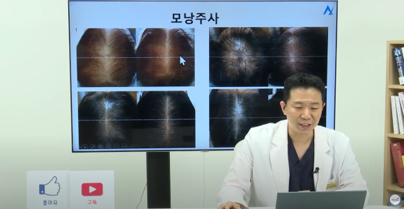 [비온뒤X뉴헤어]여성 탈모치료, 탈모 이렇게 치료해요 관련 이미지 8