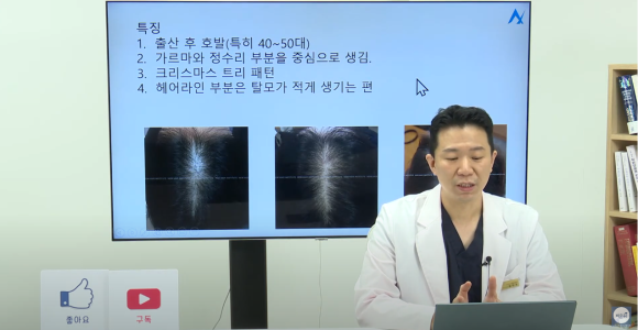 [비온뒤X뉴헤어]여성 탈모치료, 탈모 이렇게 치료해요 관련 이미지 3