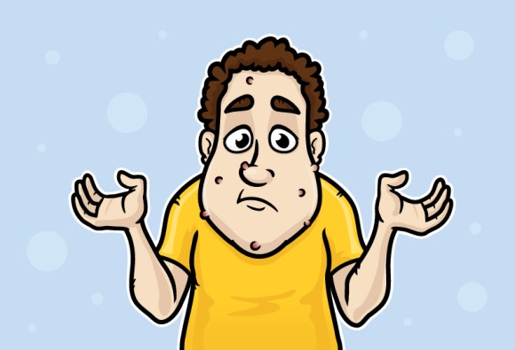 미녹시딜 부작용이 있다면 안쓰는 것이 낫나요? 관련 이미지 4