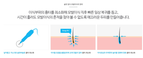 모발이식 나이 알아보고 결정해요 관련 이미지 4