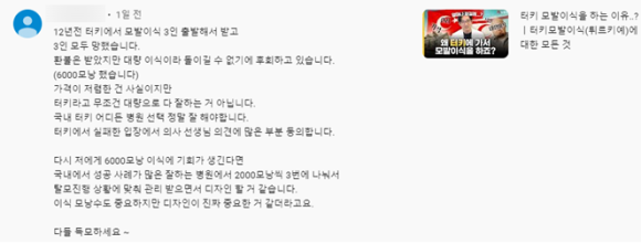 모발이식 성지 대결, 한국 VS 튀르키예(터키) 비교 관련 이미지 2