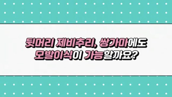 모발이식, 쌍가마에도 가능할까? ㅣ모발이식 제비추리 관련 이미지 1