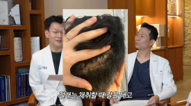 A Complete Guide to Non-Incisional Hair Transplant Methods image 2
