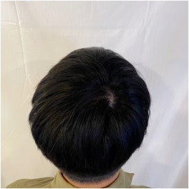남성탈모병원? 의사는 가족에게 관련 이미지 4