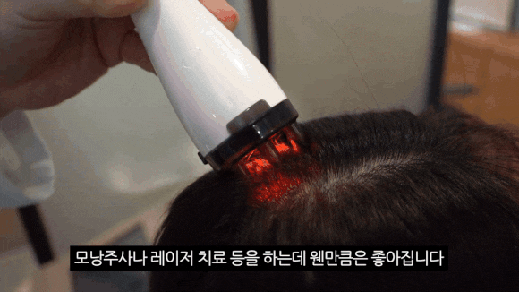 탈모 진단 병원, 초기 증상과 예방법 정리 관련 이미지 5
