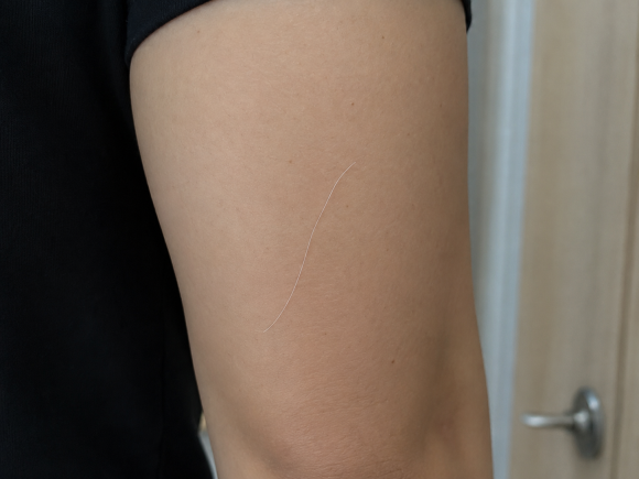 Why You Suddenly Grow a Long White Hair on Your Body image 2