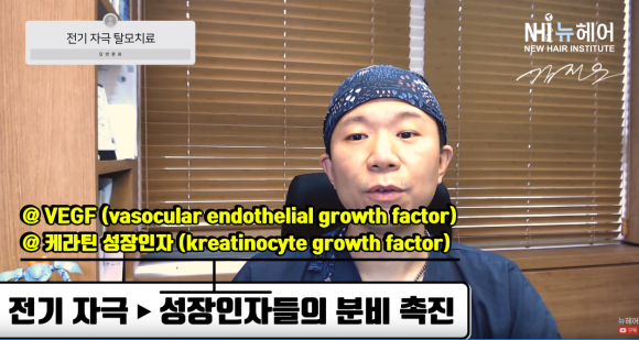 새로운 탈모 치료? 전기 자극 = 탈모약 효과?! 관련 이미지 3