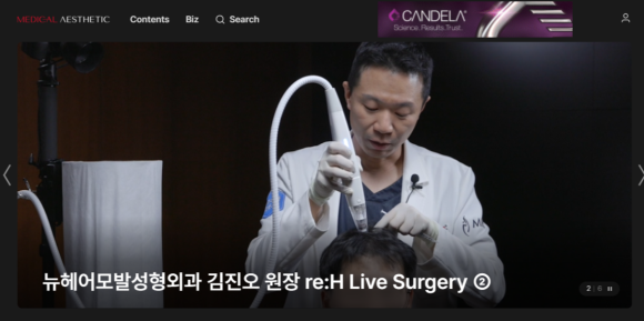 온라인 잡지 메디컬에스테틱스, 마이크로 니들링 라이브 시술 관련 이미지 1